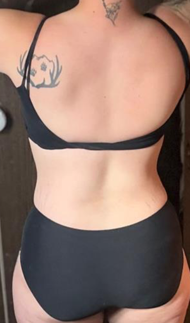 After — back view