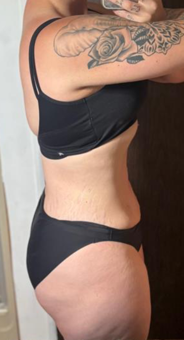 After — side view