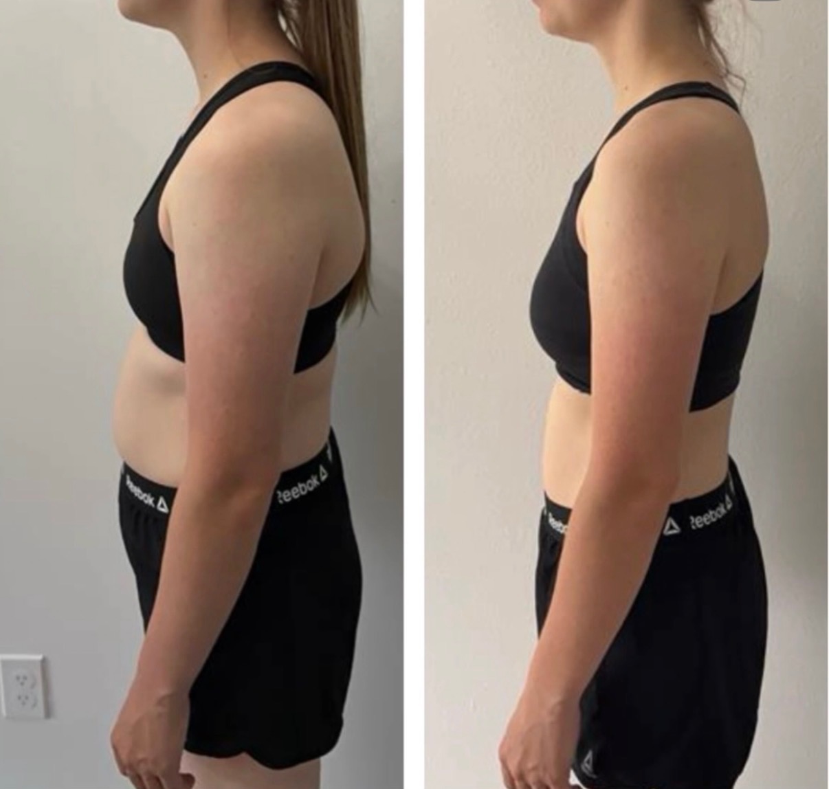 Before and after — side view