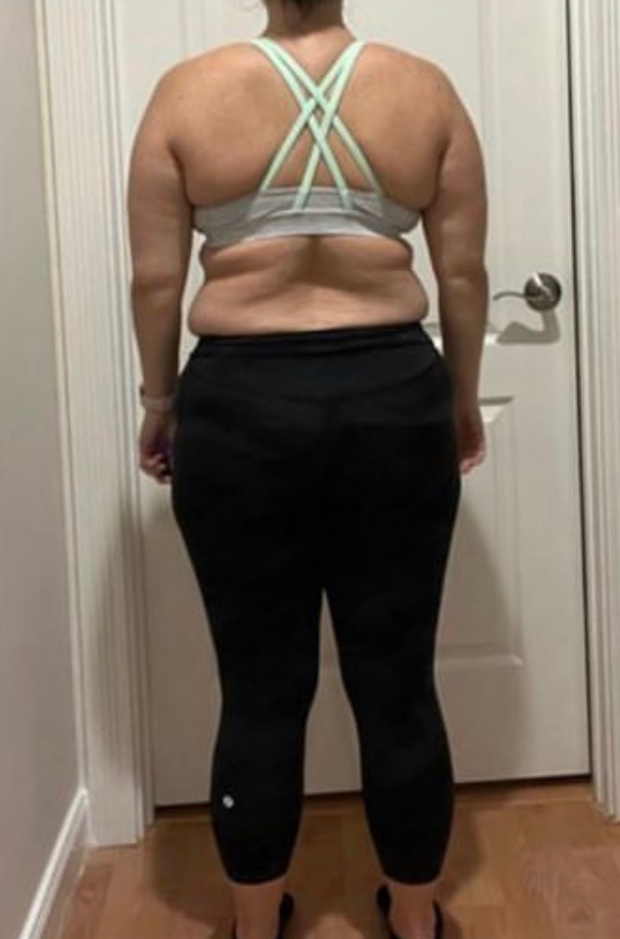 Before — back view